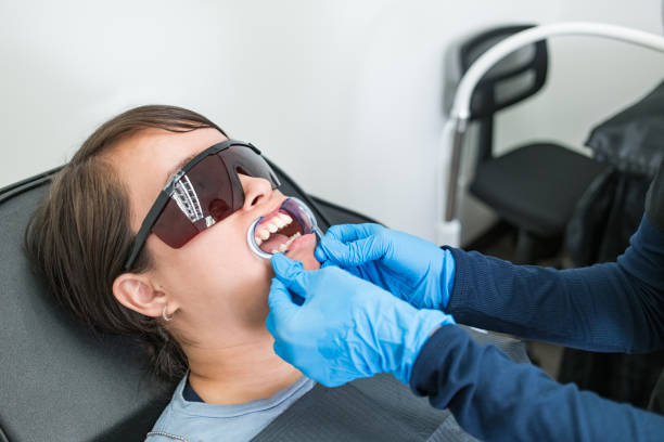 Best Teeth Whitening  in Hartington, NE