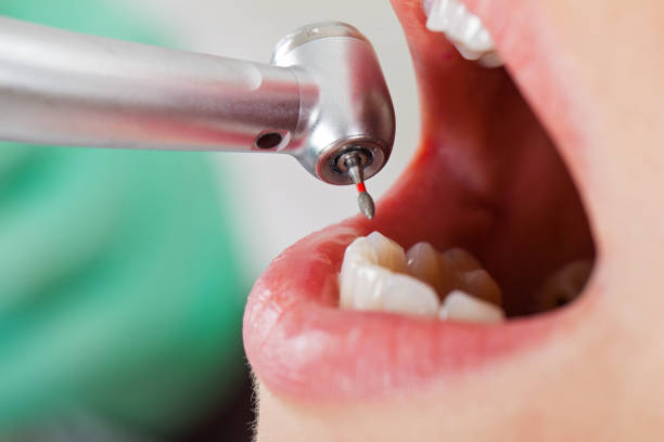 Teeth Whitening in NE